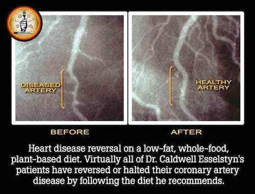 vegan diet heart problems